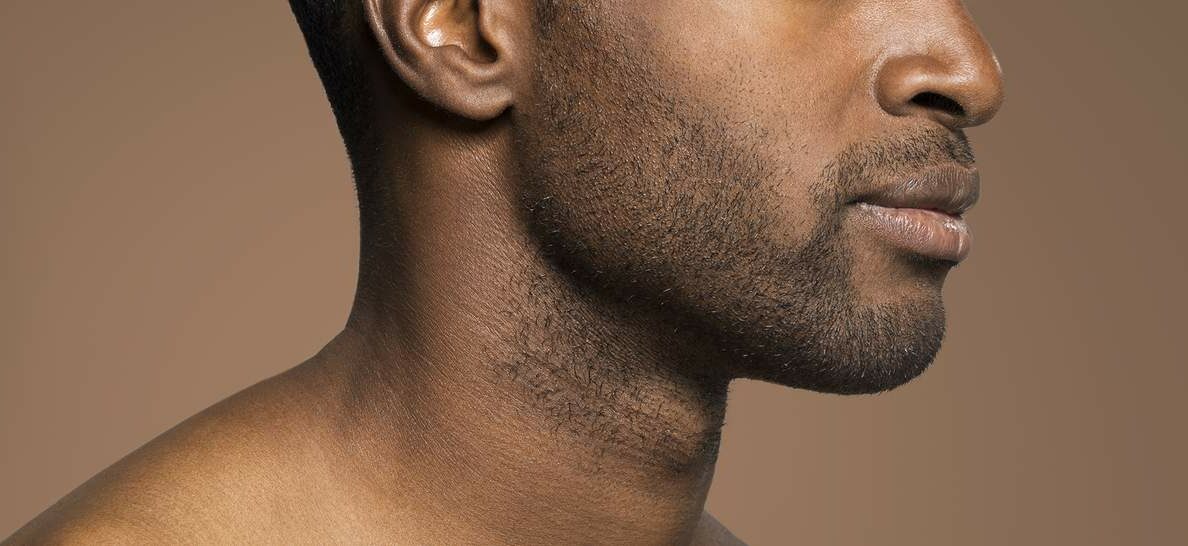 Masculinização Facial